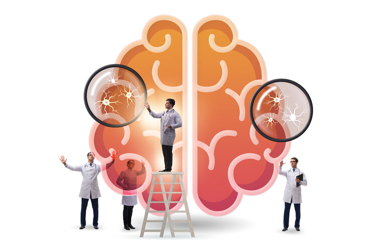 Graphic of a team of doctors examining and repairing a brain - Neuroplasticity after brain injury